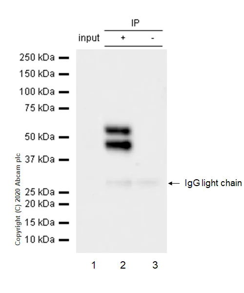 Immunoprecipitation - Anti-JNK1 (phospho Y185) + JNK2 (phospho Y185) + JNK3 (phospho Y223) antibody [EP1597Y] (AB76572)