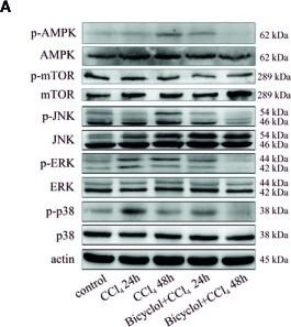 Western blot - Anti-JNK1 (phospho Y185) + JNK2 (phospho Y185) + JNK3 (phospho Y223) antibody [EP1597Y] (AB76572), expandable thumbnail