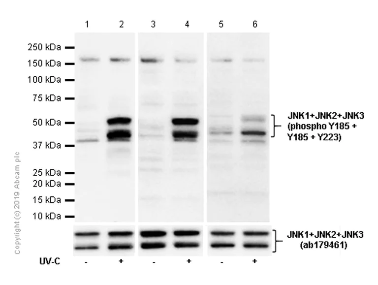 Western blot - Anti-JNK1 (phospho Y185) + JNK2 (phospho Y185) + JNK3 (phospho Y223) antibody [EP1597Y] (AB76572)