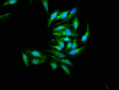 Immunocytochemistry/ Immunofluorescence - Anti-JNK2 antibody (AB236111)