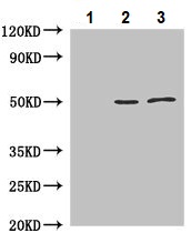 Immunoprecipitation - Anti-JNK2 antibody (AB236111), expandable thumbnail