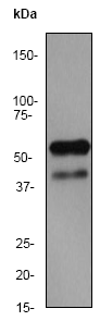 Western blot - Anti-JNK2 antibody [EP1595Y] (AB76125), expandable thumbnail