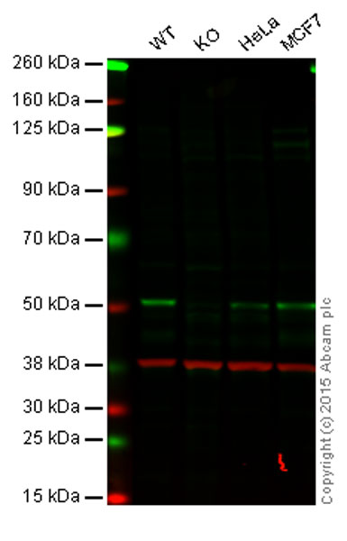 Western blot - Anti-JNK2 antibody [EP1595Y] (AB76125), expandable thumbnail