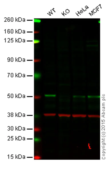 Western blot - Anti-JNK2 antibody [EP1595Y] (AB76125)
