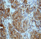Immunohistochemistry (Formalin/PFA-fixed paraffin-embedded sections) - Anti-JNK2 antibody [EP1595Y] - BSA and Azide free (AB227986)