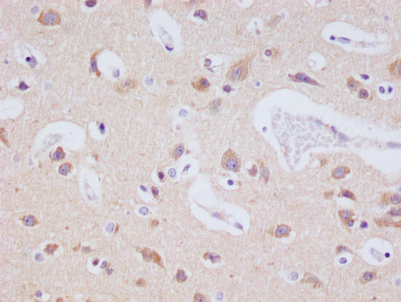 Immunohistochemistry (Formalin/PFA-fixed paraffin-embedded sections) - Anti-JNK3 antibody [29E10] (AB314190), expandable thumbnail