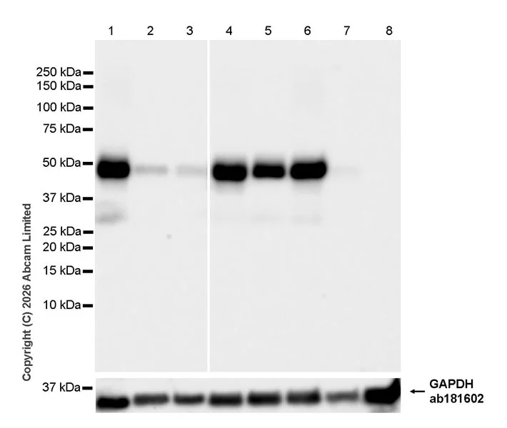 Western blot - Anti-JNK3 antibody [EPR29664-135] (AB326931)