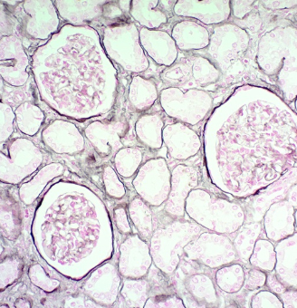 Immunohistochemistry (Formalin/PFA-fixed paraffin-embedded sections) - Jones Stain Kit (Basement Membrane) (AB245883)