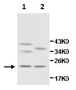 Western blot - Anti-JOSD1 antibody (AB118221)