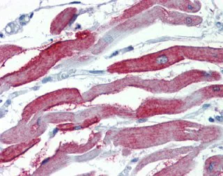Immunohistochemistry (Formalin/PFA-fixed paraffin-embedded sections) - Anti-JP-2 antibody (AB110056)