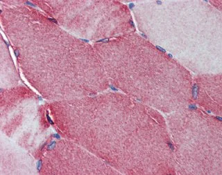 Immunohistochemistry (Formalin/PFA-fixed paraffin-embedded sections) - Anti-JP-2 antibody (AB110056)