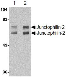 Western blot - Anti-JP-2 antibody (AB110056)