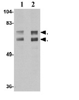 Western blot - Anti-JP-2 antibody (AB79071)