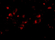 Immunocytochemistry/ Immunofluorescence - Anti-JP-4 antibody (AB79067)