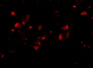 Immunocytochemistry/ Immunofluorescence - Anti-JP-4 antibody (AB79067)
