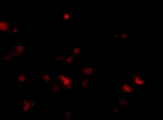 Immunocytochemistry/ Immunofluorescence - Anti-JPH3 antibody (AB79063)