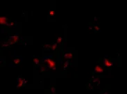 Immunocytochemistry/ Immunofluorescence - Anti-JPH3 antibody (AB79063)