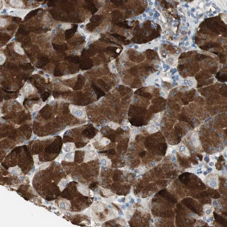 Immunohistochemistry (Formalin/PFA-fixed paraffin-embedded sections) - Anti-JTB antibody (AB254640)