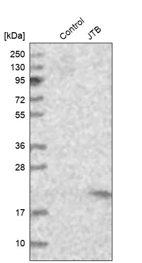 Western blot - Anti-JTB antibody (AB254640)