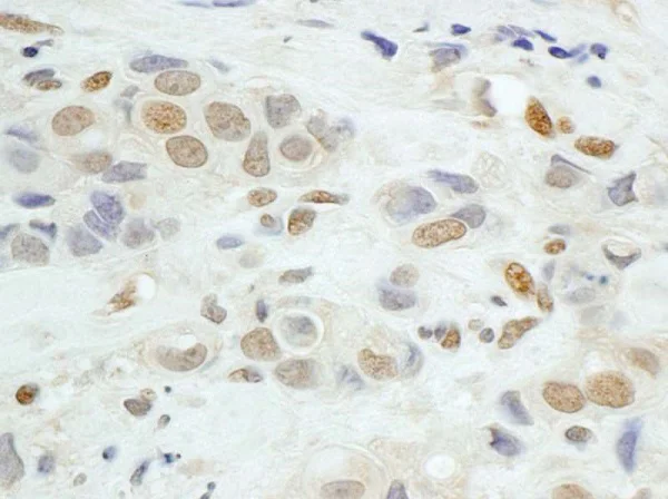 Immunohistochemistry (Formalin/PFA-fixed paraffin-embedded sections) - Anti-JunB antibody (AB245500)