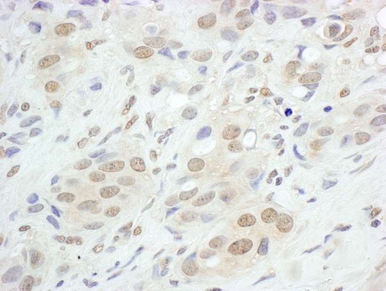 Immunohistochemistry (Formalin/PFA-fixed paraffin-embedded sections) - Anti-JunB antibody (AB264302), expandable thumbnail