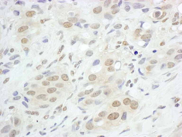 Immunohistochemistry (Formalin/PFA-fixed paraffin-embedded sections) - Anti-JunB antibody (AB264302)
