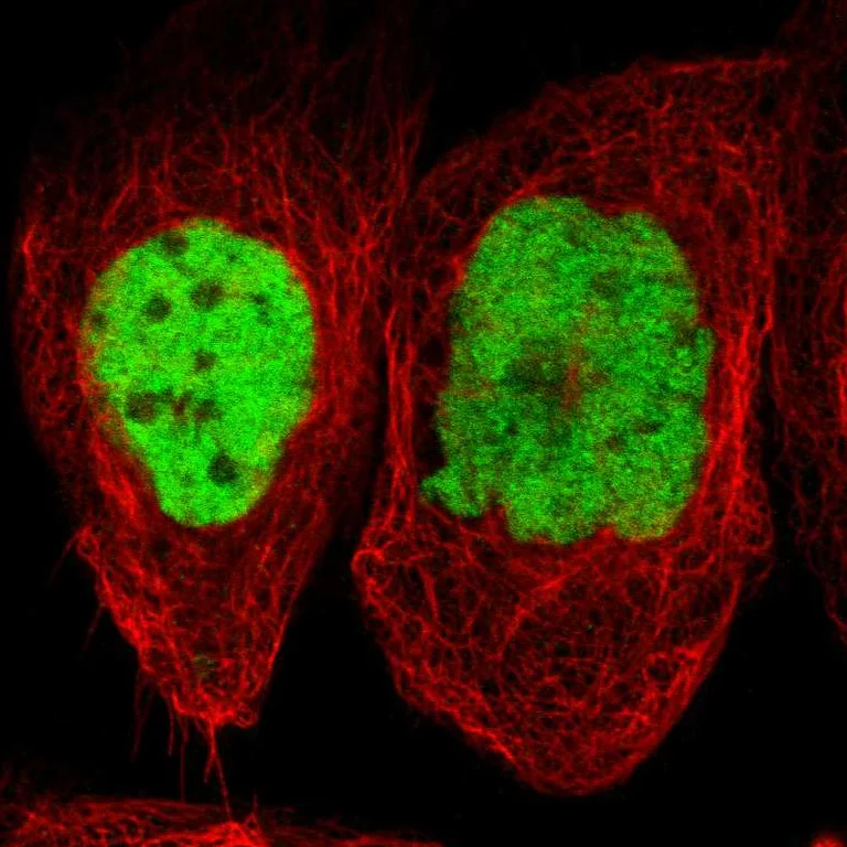 Immunocytochemistry/ Immunofluorescence - Anti-JUNB Antibody (AB327194)