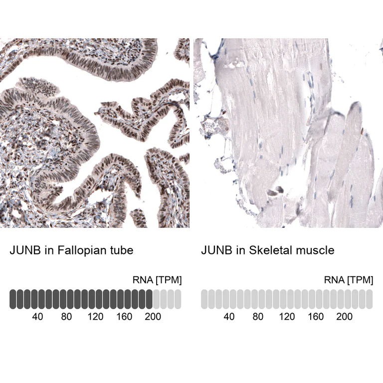 Immunohistochemistry (Formalin/PFA-fixed paraffin-embedded sections) - Anti-JUNB Antibody (AB327194)