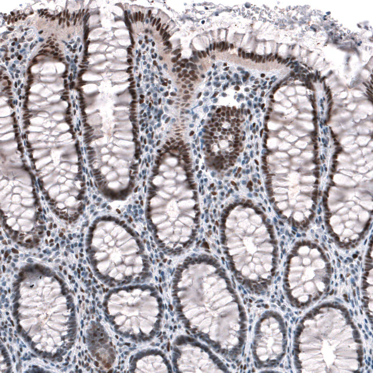 Immunohistochemistry (Formalin/PFA-fixed paraffin-embedded sections) - Anti-JUNB Antibody (AB327194)
