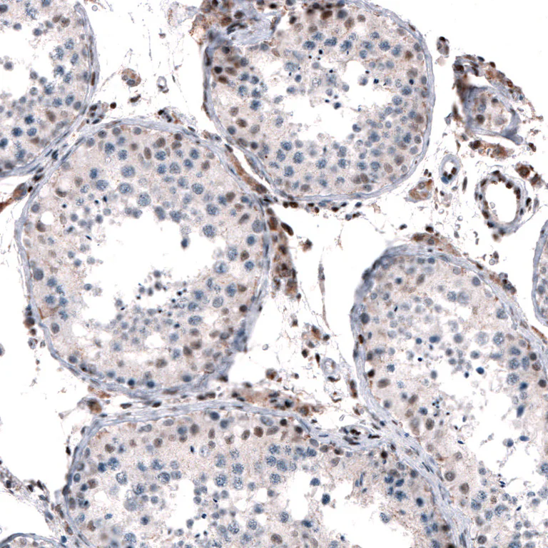 Immunohistochemistry (Formalin/PFA-fixed paraffin-embedded sections) - Anti-JUNB Antibody (AB327194)