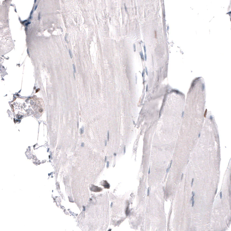 Immunohistochemistry (Formalin/PFA-fixed paraffin-embedded sections) - Anti-JUNB Antibody (AB327194)