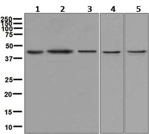 Western blot - Anti-JunB antibody [EPR6518] (AB128878)