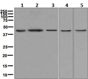 Western blot - Anti-JunB antibody [EPR6518] (AB128878)