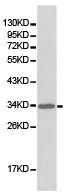 Western blot - Anti-Junctional Adhesion Molecule 1/JAM-A antibody (AB180821)