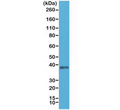 Western blot - Anti-Junctional Adhesion Molecule 1/JAM-A antibody [RM275] - N-terminal (AB238313)