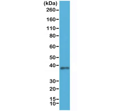Western blot - Anti-Junctional Adhesion Molecule 1/JAM-A antibody [RM275] - N-terminal (AB238313)