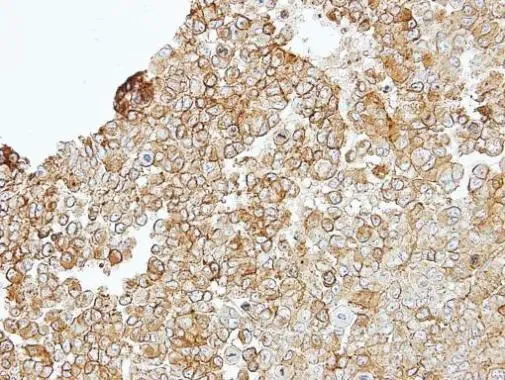 Immunohistochemistry (Formalin/PFA-fixed paraffin-embedded sections) - Anti-Junctional Adhesion Molecule 2/JAM-B antibody (AB96465)