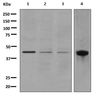 Western blot - Anti-Junctional Adhesion Molecule 2/JAM-B antibody [EPR2489(2)] (AB156586), expandable thumbnail