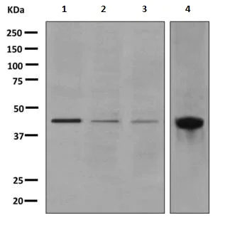 Western blot - Anti-Junctional Adhesion Molecule 2/JAM-B antibody [EPR2489(2)] - BSA and Azide free (AB249274)