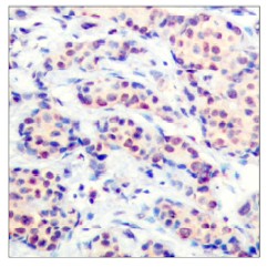 Immunohistochemistry (Formalin/PFA-fixed paraffin-embedded sections) - Anti-JunD antibody (AB28837)