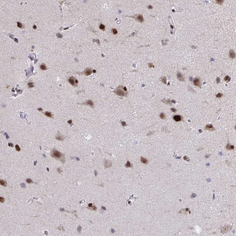 Immunohistochemistry (Formalin/PFA-fixed paraffin-embedded sections) - Anti-JUND Antibody (AB327256)