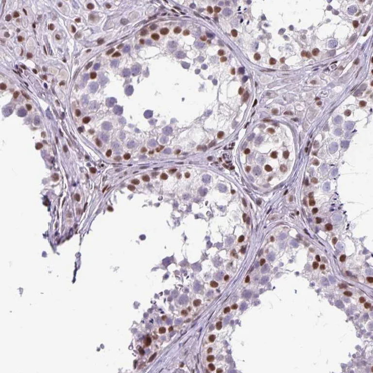 Immunohistochemistry (Formalin/PFA-fixed paraffin-embedded sections) - Anti-JUND Antibody (AB327256)