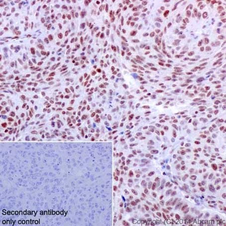 Immunohistochemistry (Formalin/PFA-fixed paraffin-embedded sections) - Anti-JunD antibody [EPR17365] - BSA and Azide free (AB250511)