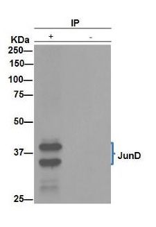 Anti-JunD antibody [EPR6520]
