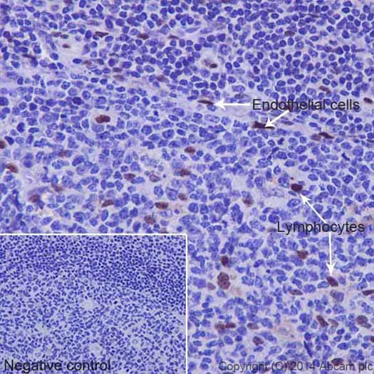 Immunohistochemistry (Formalin/PFA-fixed paraffin-embedded sections) - Anti-JunD (phospho S100) + c-Jun (phospho S73) antibody [EPR16586] (AB178858)