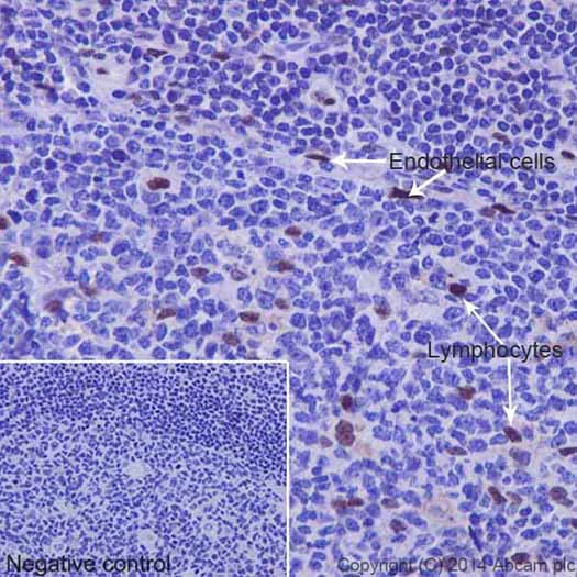 Immunohistochemistry (Formalin/PFA-fixed paraffin-embedded sections) - Anti-JunD (phospho S100) + c-Jun (phospho S73) antibody [EPR16586] (AB178858)