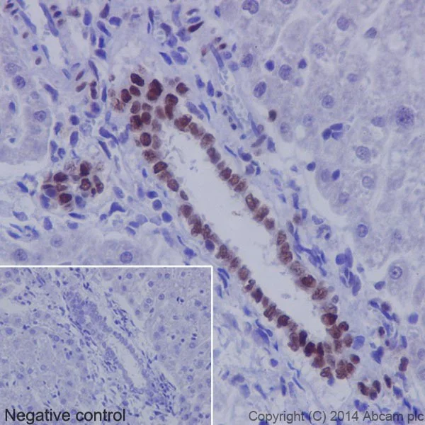 Immunohistochemistry (Formalin/PFA-fixed paraffin-embedded sections) - Anti-JunD (phospho S100) + c-Jun (phospho S73) antibody [EPR16586] (AB178858)