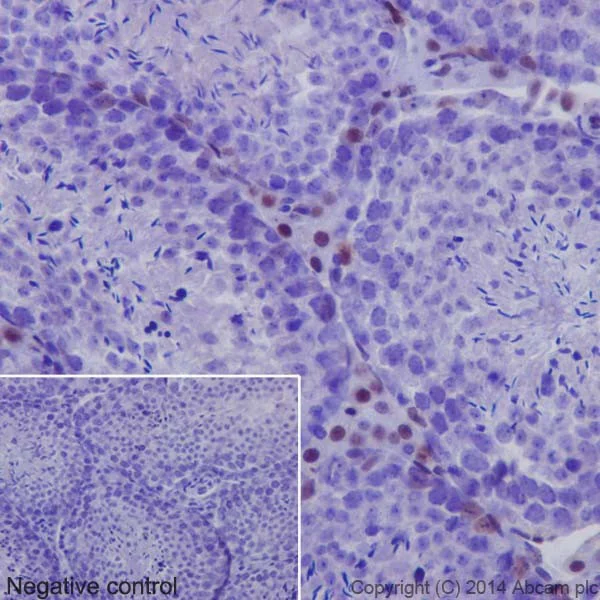 Immunohistochemistry (Formalin/PFA-fixed paraffin-embedded sections) - Anti-JunD (phospho S100) + c-Jun (phospho S73) antibody [EPR16586] - BSA and Azide free (AB250081)