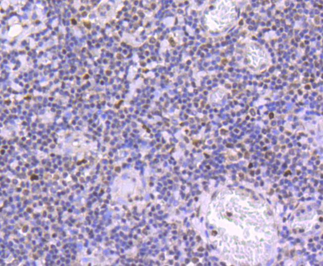 Immunohistochemistry (Formalin/PFA-fixed paraffin-embedded sections) - Anti-JunD (phospho S255) antibody [JJ08-21] (AB326637)