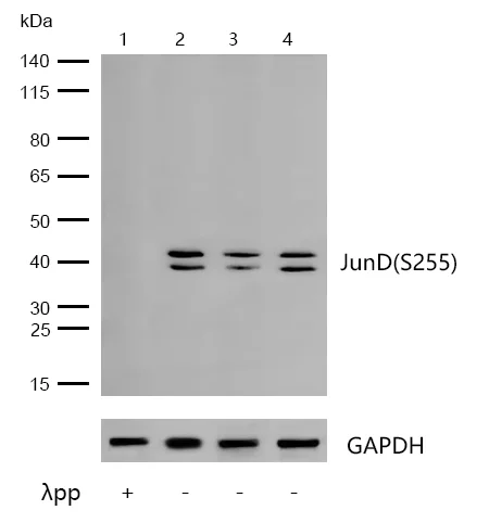 Western blot - Anti-JunD (phospho S255) antibody [JJ08-21] (AB326637)